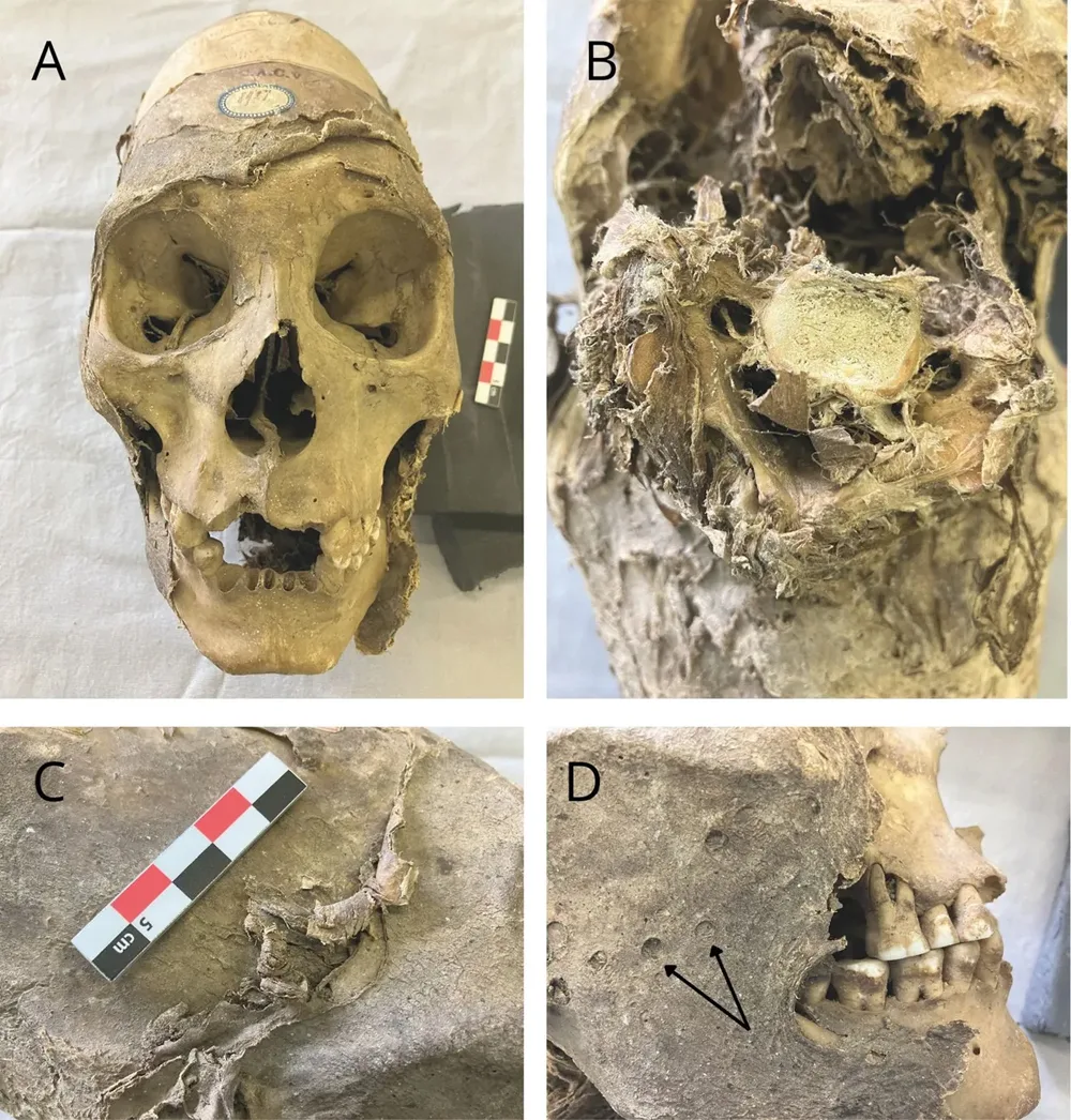 Această fotografie compozită a capului arată (A) fața; (B) interiorul gâtului, care pare mai degrabă smuls decât tăiat; (C) un prim-plan al capului în apropierea ochiului drept și (D) „urme de variolă” pe obrazul drept, posibil cauzate de insecte.



