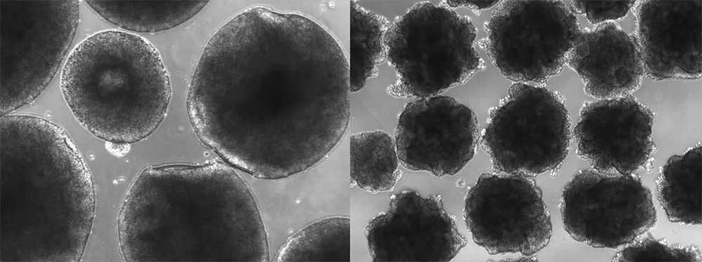 Organoide cerebrale umane derivate din celule stem pluripotente umane (stânga) și modificate genetic cu varianta neandertaliană a genei NOVA1 (dreapta).