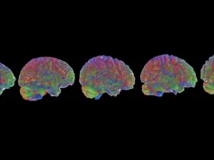 Creierul uman are 5 vârste distincte