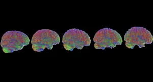 Creierul uman are 5 vârste distincte