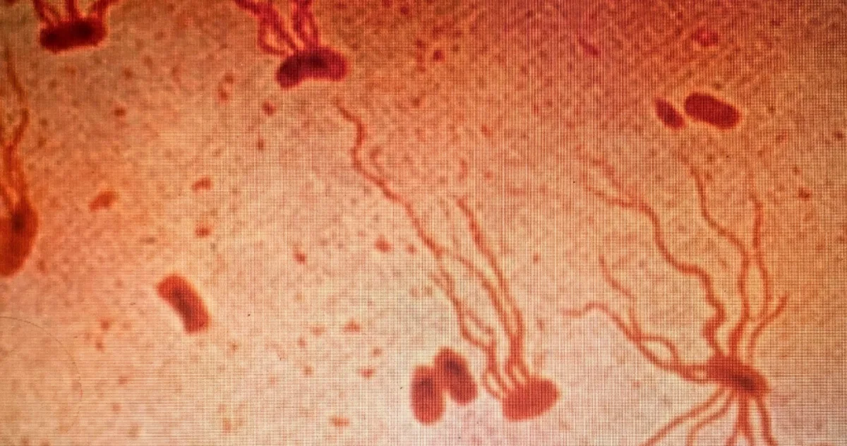 boală mortală străveche