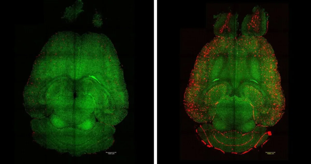 O nouă nanotehnologie ar putea „curăța creierul de Alzheimer”