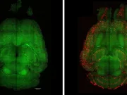 O nouă nanotehnologie ar putea „curăța creierul de Alzheimer” și inversa pierderea memoriei, sugerează un studiu pe șoareci O nouă nanotehnologie ar putea „curăța creierul de Alzheimer”