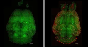 O nouă nanotehnologie ar putea „curăța creierul de Alzheimer”