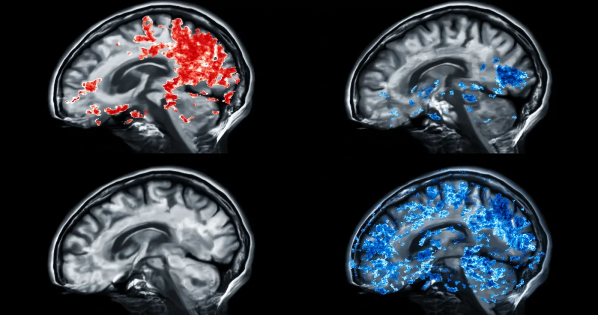 5 semnături genetice