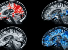 Răsturnare de situație în medicină: cele 5 semnături genetice care rescriu tot ce știam despre bolile mintale 5 semnături genetice