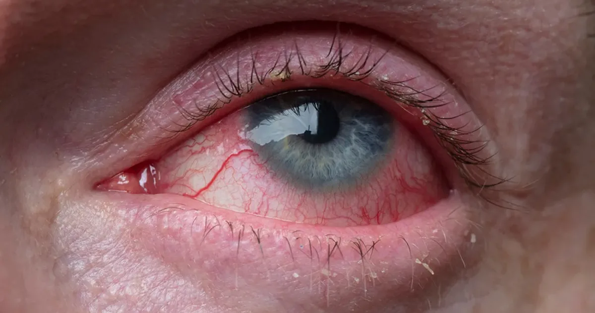 Randy Gardner a aruncat o monedă în sus și a devenit cel mai „nedormit” om