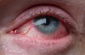 În 1963, Randy Gardner a aruncat o monedă în sus și a devenit cel mai „nedormit” om din istorie Randy Gardner a aruncat o monedă în sus și a devenit cel mai „nedormit” om