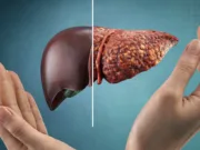 Cercetătorii identifică mecanismul cheie care determină progresia bolii ficatului gras către cancer progresia bolii ficatului gras către cancer