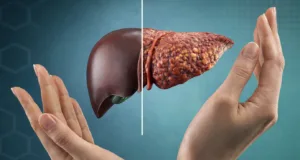 progresia bolii ficatului gras către cancer