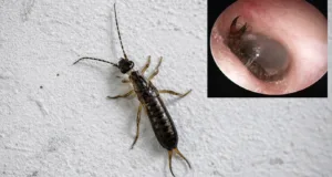 Intră urechelnițele în urechile oamenilor