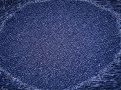 Premieră medicală: Japonia aprobă primele tratamente din lume cu celule umane reprogramate tratamente cu celule umane reprogramate japonia