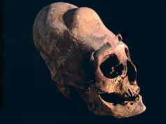 Cranii antice „cu aspect extraterestru”, găsite pe toate continentele, în afară de Antarctica: antropologii explică de ce Cranii antice „cu aspect extraterestru”, găsite pe toate continentele