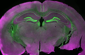 Neuronii dintr-un creier înghețat la -196°C au răspuns la stimuli electrici după decongelare neuroni dintr-un creier inghetat