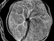 „Nimeni nu știe ce sunt”: Cercetătorii au descoperit un nou tip de celule care apar exclusiv în timpul sarcinii nou tip de celule sarcina