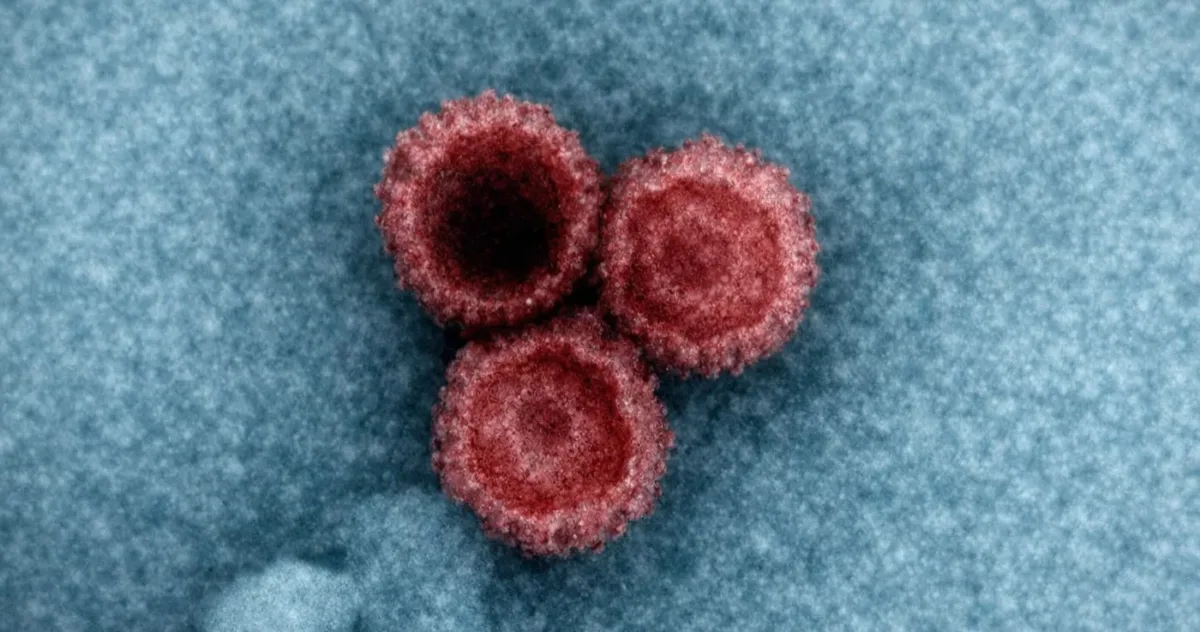 virusuri latente în organism