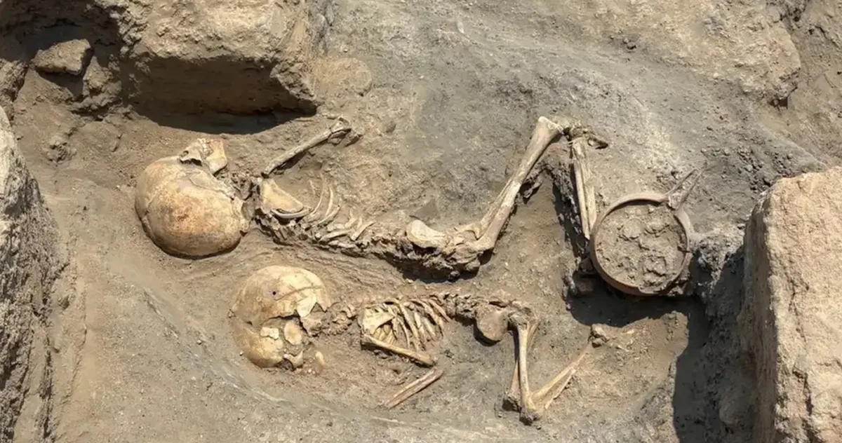 trepanație craniană antică