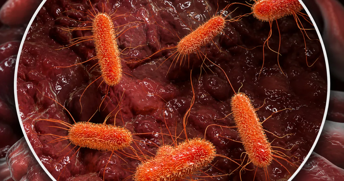 microbiom intestinal autism