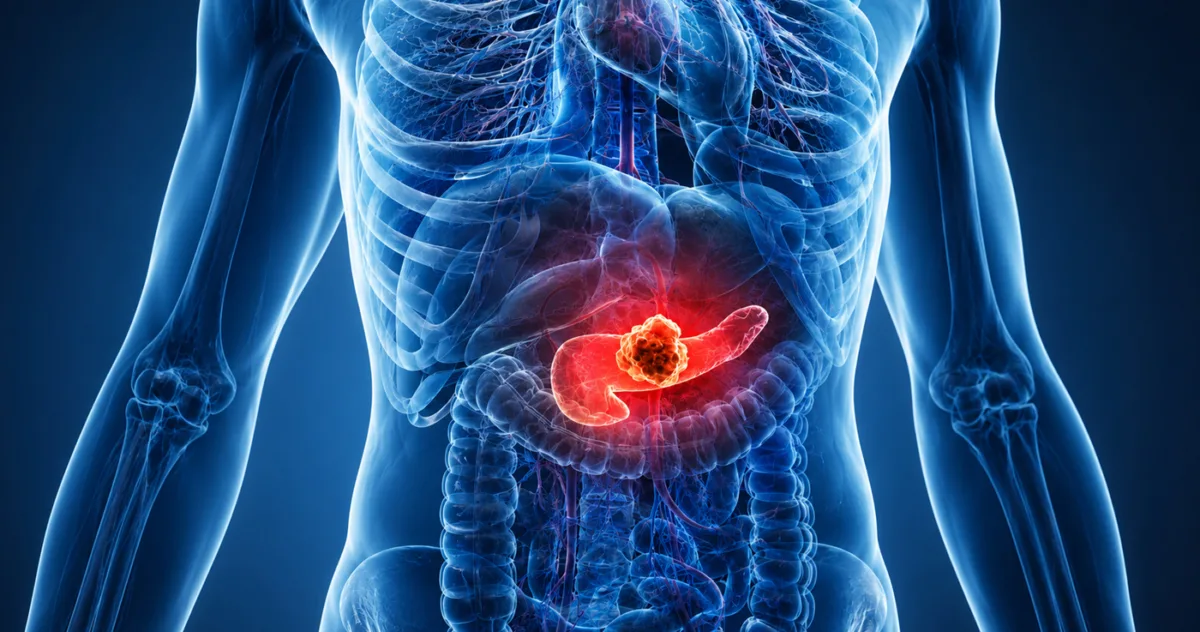 vaccin cancer pancreatic