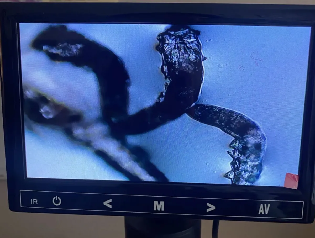 Demodex la microscop