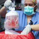 transplant rinichi de porc