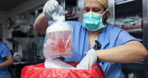 transplant rinichi de porc