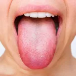 bacteriile din gură