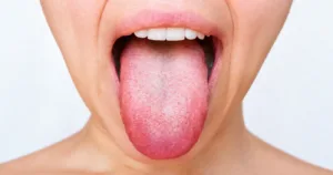 bacteriile din gură