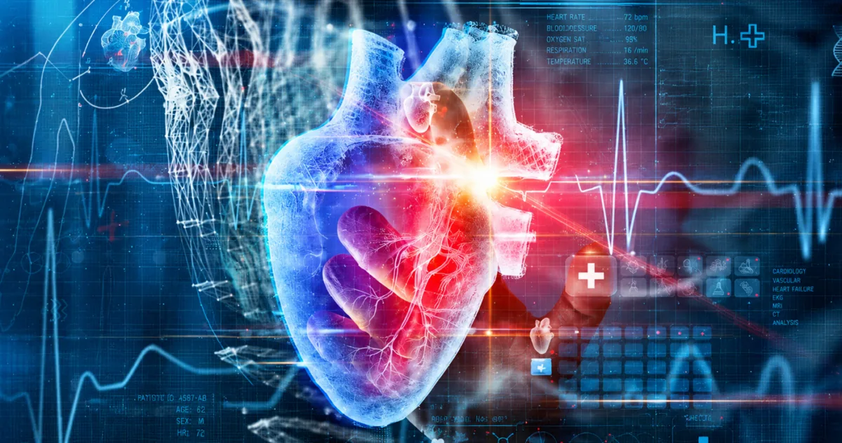 EKG moarte subită