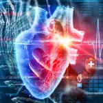 EKG moarte subită