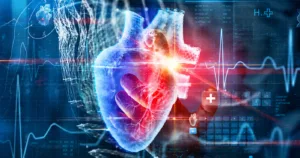 EKG moarte subită