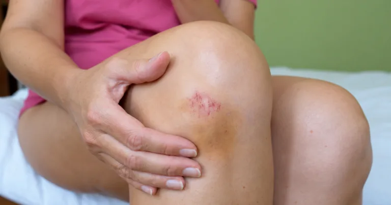 hormonii și celulele stem ale pielii
