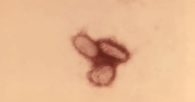 O genă umană furată de un virus se comportă cum nu s-a mai văzut până acum